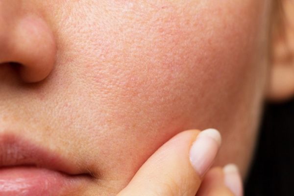 berikut tips menjaga kulit wajah agar sehat dan cantik 54349