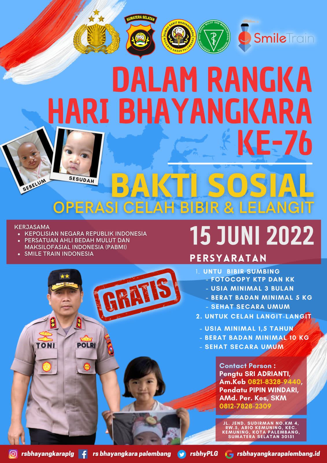 sambut hari bhayangkara ke 76 polda sumsel gelar operasi bibir sumbing gratis 47316