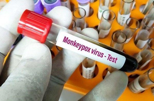 wabah cacar monyet masyarakat diimbau untuk tidak panik dan tetap waspada 49105