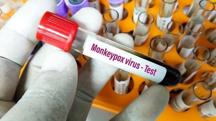 wabah cacar monyet masyarakat diimbau untuk tidak panik dan tetap waspada 49105