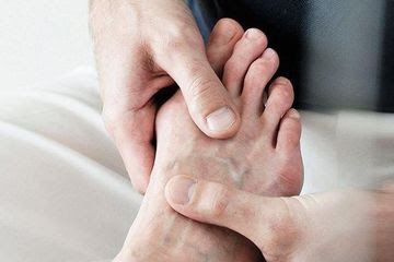 waspada ini 5 tanda kolesterol tinggi di bagian kaki 63509