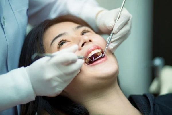 waspadai ini sederet efek karang gigi yang berbahaya bagi kesehatan 72270 1