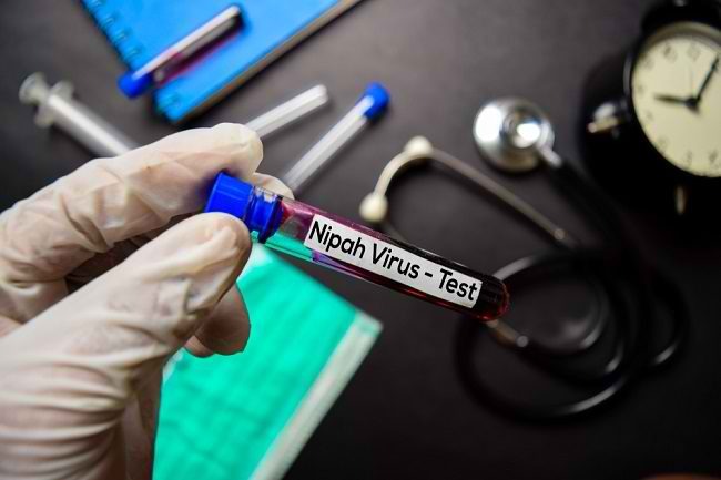 waspadai penyebab dan gejala virus nipah 63979