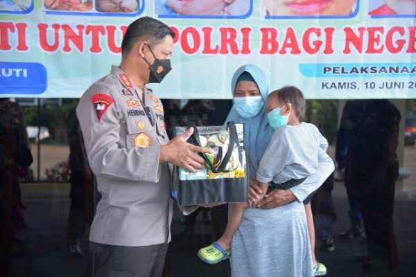 ahead of bhayangkara day 2021 the lampung regional police hold cleft lip surgery mass circumcision and social service 28814