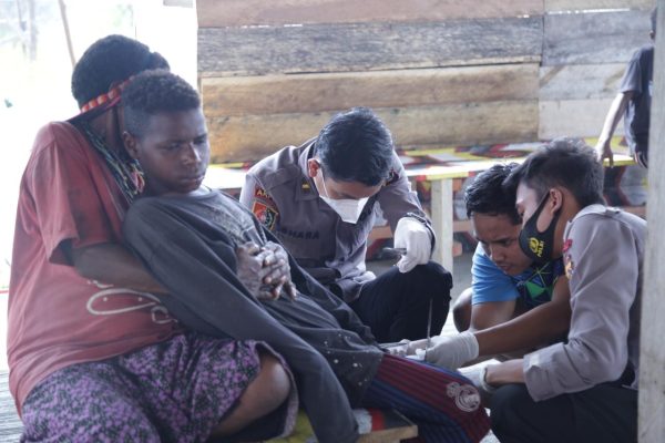 aksi binmas noken wilayah nduga beri pengobatan kepada seorang anak yang menderita luka sobek 45958