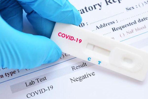 cegah penyebaran covid 19 polda kalsel ciptakan aplikasi si walan untuk lakukan swab test massal secara drive thru 34640