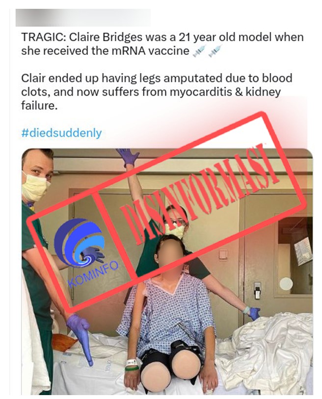 disinformasi wanita di florida harus mengamputasi kakinya karena mengalami pembekuan darah akibat vaksin covid 10 54460