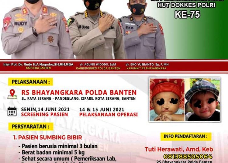hut dokkes polri ke 75 polda banten gelar operasi gratis balita penderita bibir sumbing 37344