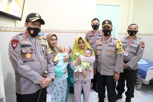 peringati hari bhayangkara ke 74 polda maluku utara gelar bakti kesehatan operasi bibir sumbing gratis 11370