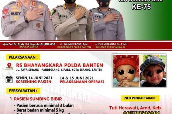 the 75th anniversary of the national police s medical doctor banten police holds a free operation for toddlers with cleft lips 28653