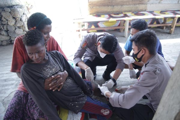 the noken community development treats a child with torn leg wound 45966