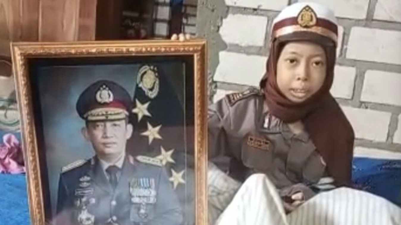 tolong pak kapolri anak penderita tumor tulang ini ingin bertemu dan dibantu 20985
